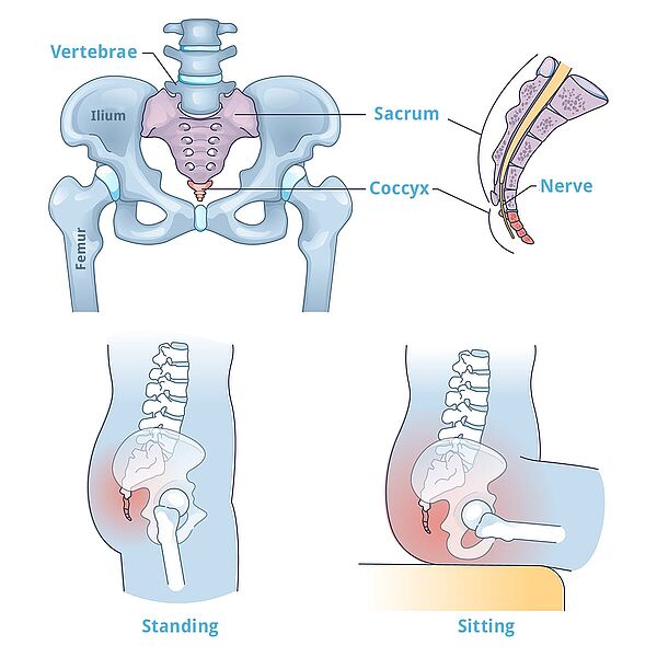 csm Coccyx Anatomy Avicenna Klinik 1200x1200px min 5942da7754 Ấn tượng là một loại thực phẩm Ấn tượng là một loại thực phẩm